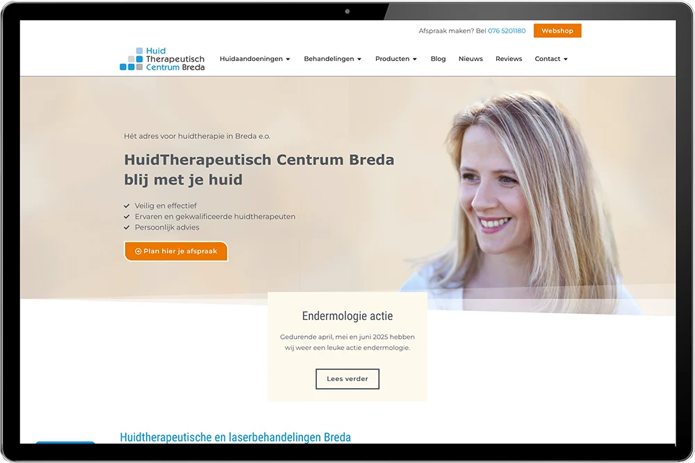 website voor huidtherapeut breda laten maken